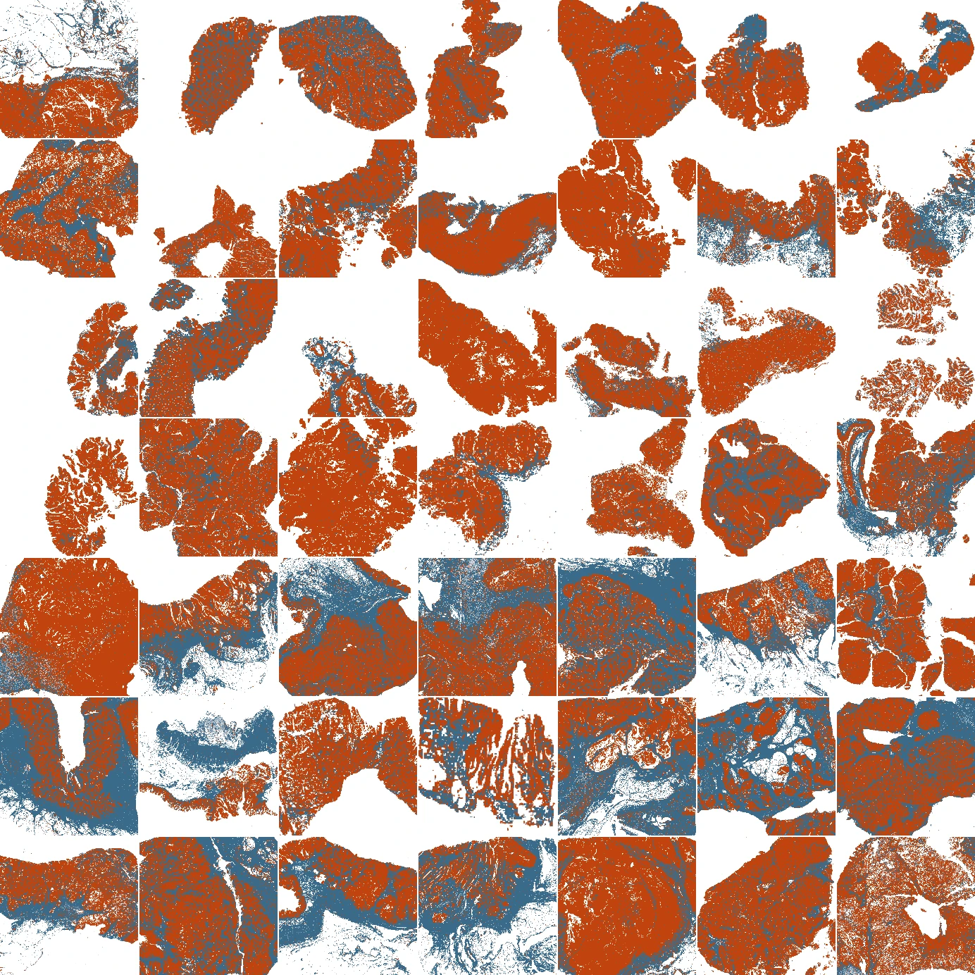 Predicted malignant, tumor-microenvironment and normal regions in the same 49 tissue regions